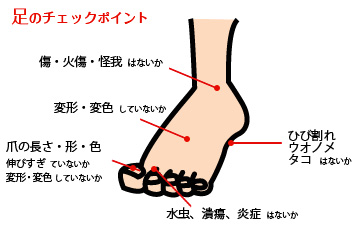 糖尿病のフットケア